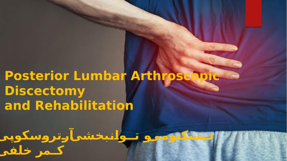 مرجع دانلود پاورپوینت Posterior Lumbar Arthroscopic Discectomy